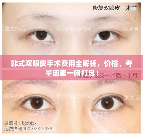 韓式雙眼皮手術(shù)費(fèi)用全解析，價格、考量因素一網(wǎng)打盡！