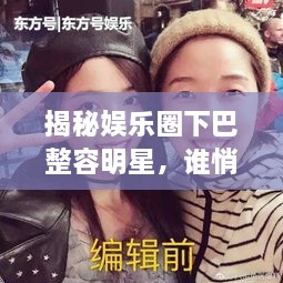揭秘娛樂圈下巴整容明星，誰悄悄整過下巴？