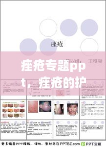 痤瘡專(zhuān)題ppt，痤瘡的護(hù)理ppt 